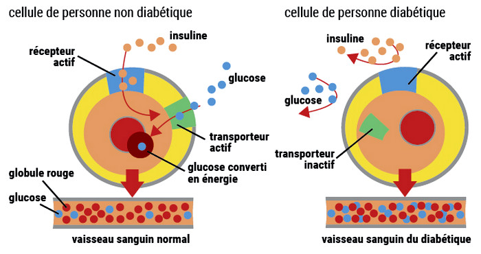 Cellules diabétique